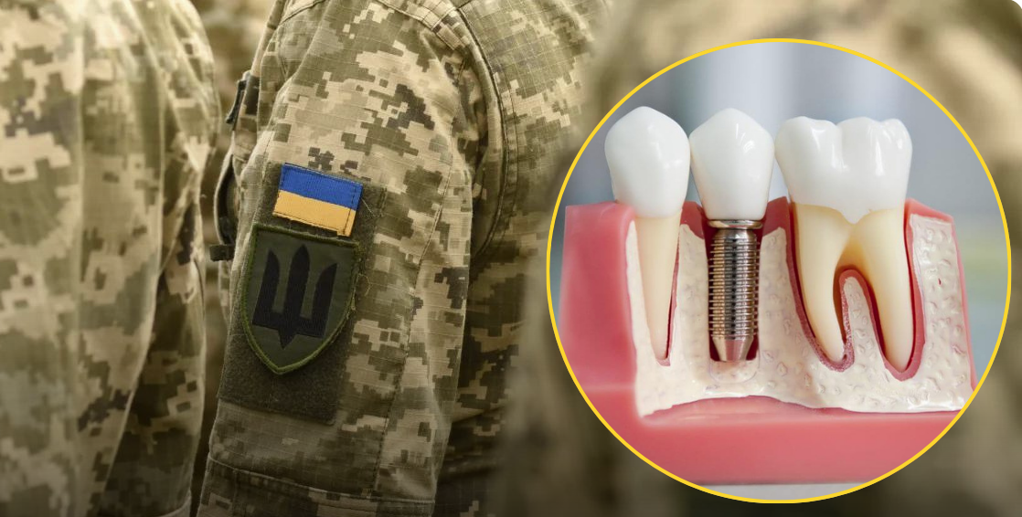 Зубопротезування для УБД